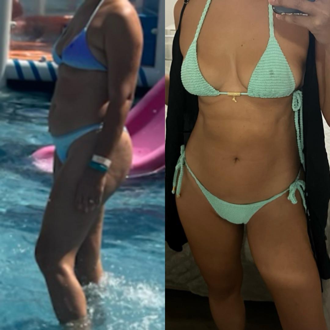 Antes e depois — caso 3